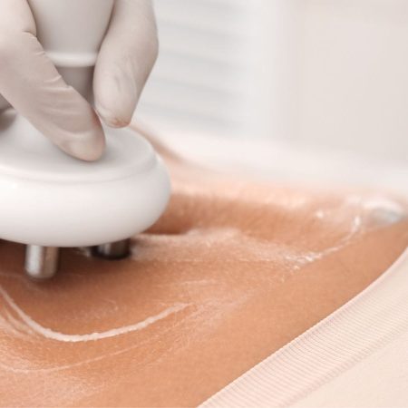 Dunakanyar Esztétika - Esztétikai kezelések, kozmetika, bőrgyógyászat- Dr Kondorosi Ildikó - Alakformálás és testkezelések Vácon