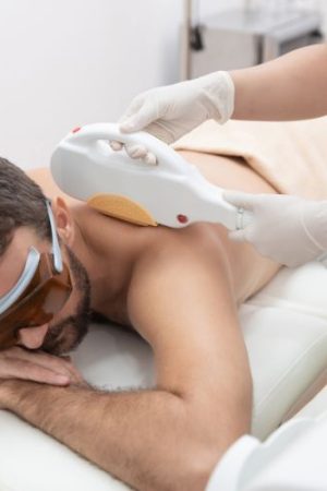 IPL végleges szőrtelenítés Vácon – Dunakanyar Esztétika IPL végleges szőrtelenítés Vácon – Dunakanyar Esztétika