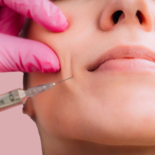 Dunakanyar Esztétikai és Bőrgyógyászati Centrum - Vác - Hyaluronsavas feltöltések (18) Dunakanyar Esztétikai és Bőrgyógyászati Centrum - Vác - Hyaluronsavas feltöltések (18)