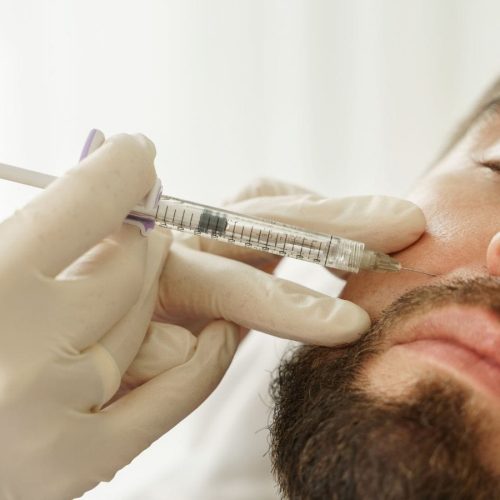 Dunakanyar Esztétikai és Bőrgyógyászati Centrum - Vác - Hyaluronsavas feltöltések (8) Dunakanyar Esztétikai és Bőrgyógyászati Centrum - Vác - Hyaluronsavas feltöltések (8)