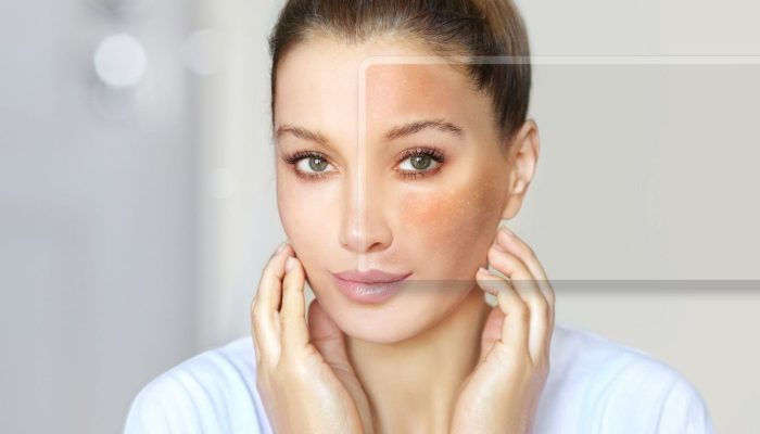 Dunakanyar Esztétikai és Bőrgyógyászati Centrum - Vác - Április