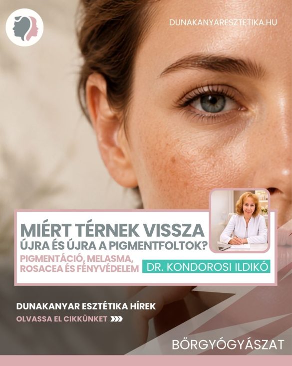 Miért térnek vissza újra és újra a pigmentfoltok – Dr. Kondorosi Ildikó