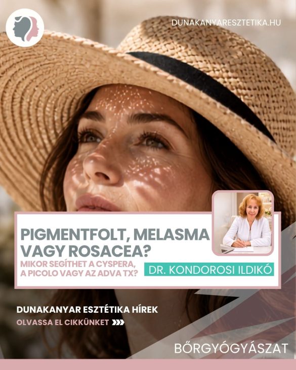 Pigmentfolt, melasma vagy rosacea Mikor segíthet a Cyspera, a PicoLO vagy az ADVA TX – Dr. Kondorosi Ildikó (1)
