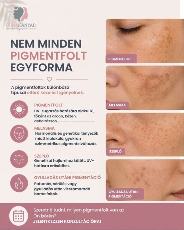 nem minden pigmentfolt egyforma
